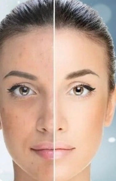 Gamme (Set) BLANCHE NEIGE — extreme brigthening fast action