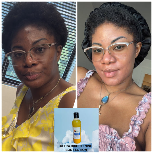 BLANCHE NEIGE BODY LOTION—BLANCHE NEIGE — extreme brigthening fast action