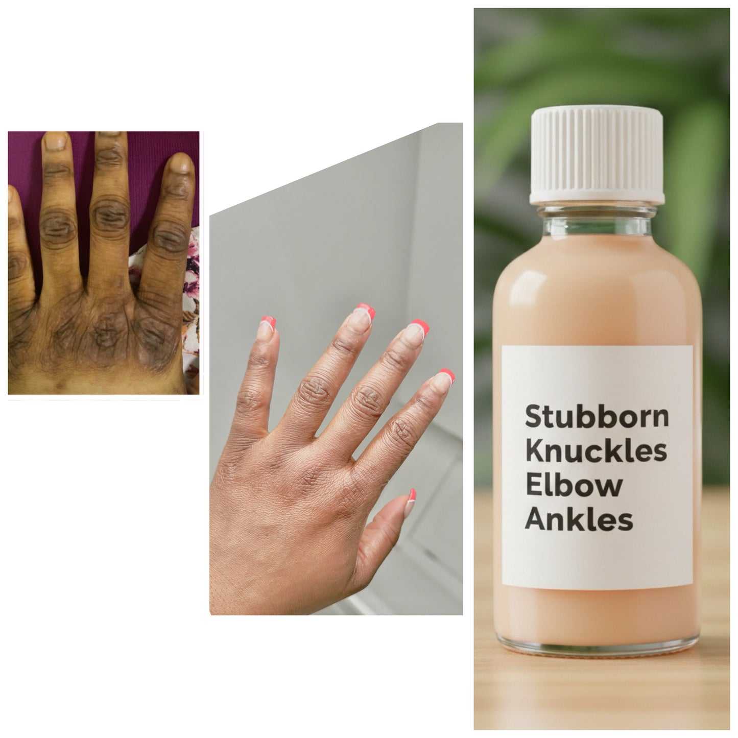 KINTO// STUBBORN KNUCKLES-ELBOW-ANKLE