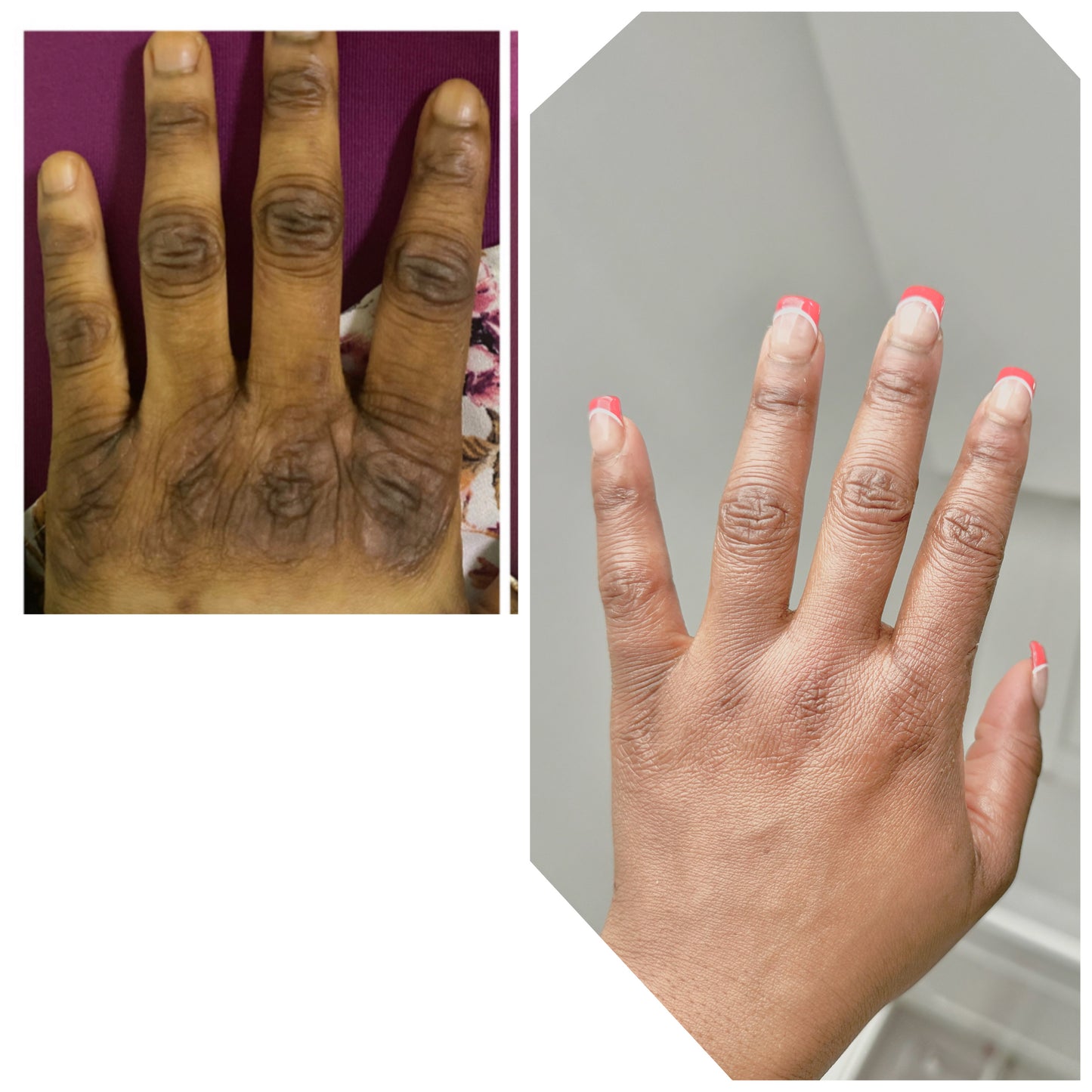 KINTO// STUBBORN KNUCKLES-ELBOW-ANKLE