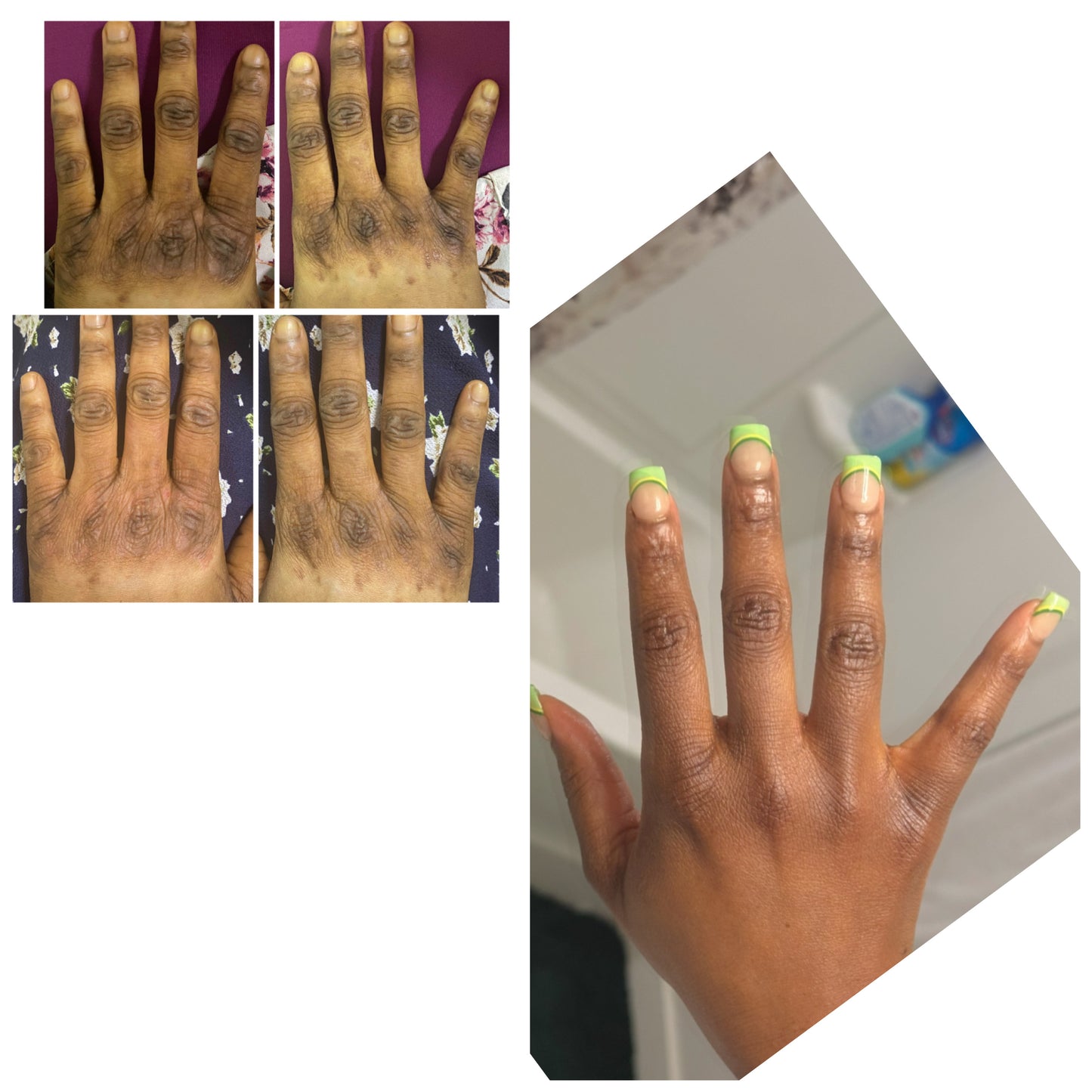 KINTO// STUBBORN KNUCKLES-ELBOW-ANKLE