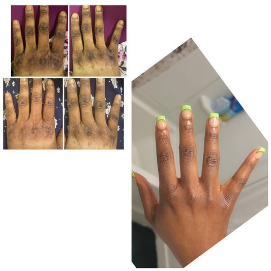 KINTO// STUBBORN KNUCKLES-ELBOW-ANKLE